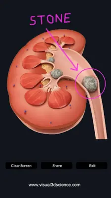 Urinary System android App screenshot 11