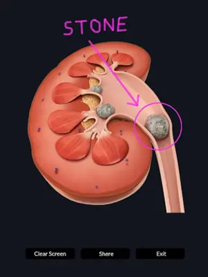 Urinary System android App screenshot 4