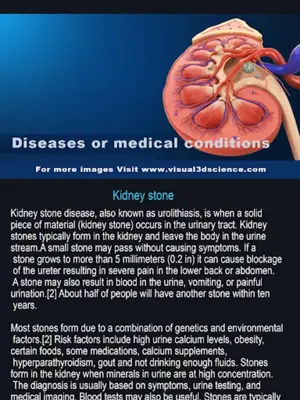 Urinary System android App screenshot 5